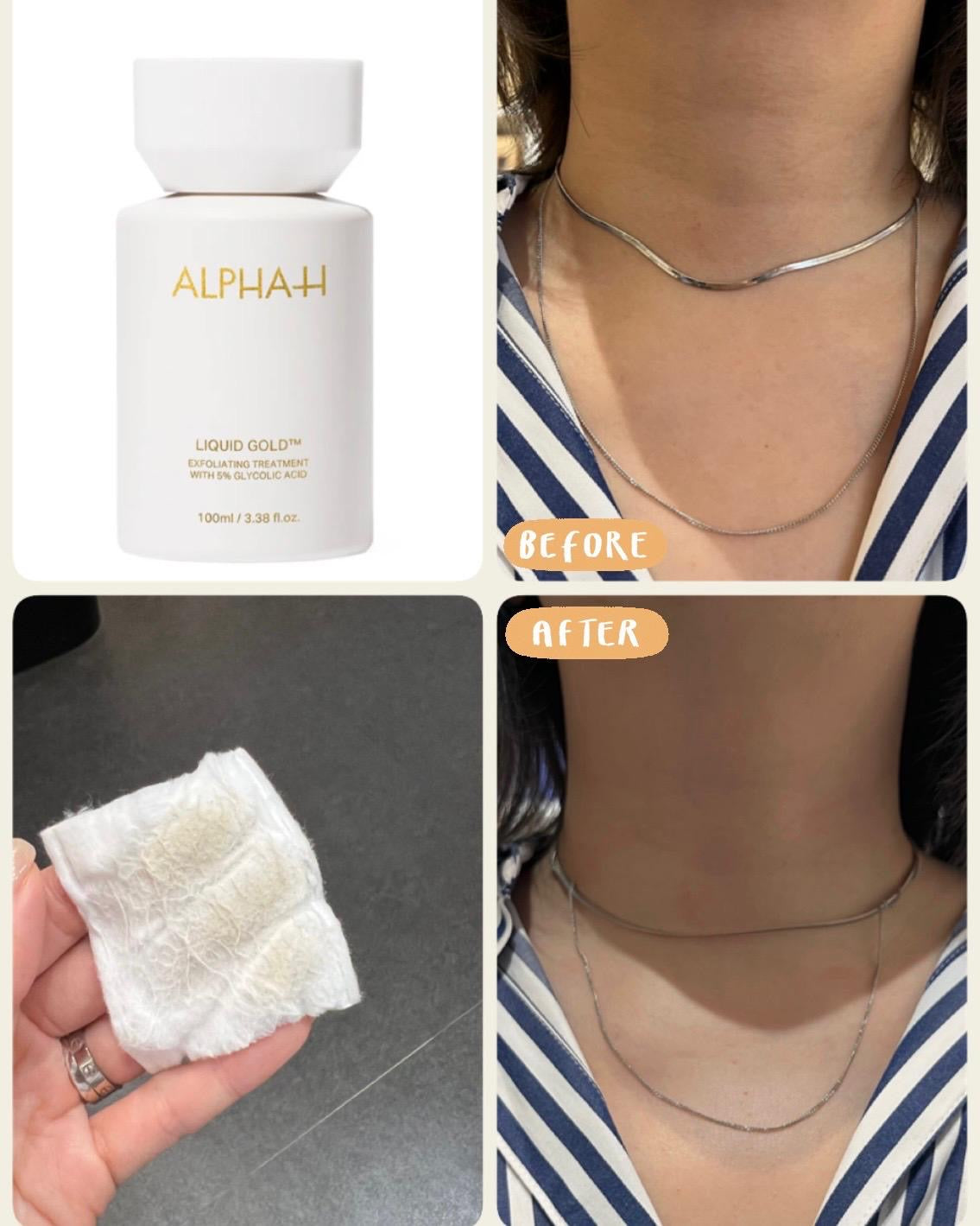 實測 ALPHA-H 黃金精華液用於頸部,使用後明顯改善粗糙與暗沉,去角質同時緊緻肌膚,重現細滑透亮。