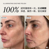 官方臨床對比圖展示，ALPHA-H 酵素洗面粉能深入淨化毛孔，溫和清走老舊死皮，令暗啞消退，回復清新透亮嫩肌。