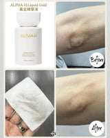 實測 ALPHA-H 黃金精華液用於手肘死角位，有效去除厚重死皮，肌膚回復柔軟平滑，解決身體粗糙問題。