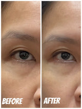 Talika 眼膜使用前後對比：敷後眼底乾紋明顯減淡，眼袋位置變得明亮有光澤，後續化妝不再卡粉起「格仔紋」。