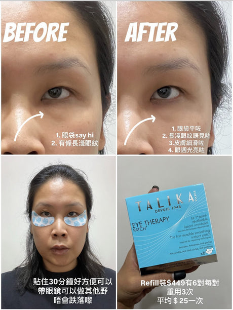 Hakme 親身實測 Talika 眼紋熨斗前後對比：敷 30 分鐘後，眼底乾紋及「格仔紋」明顯被熨平，眼周變得平滑明亮。