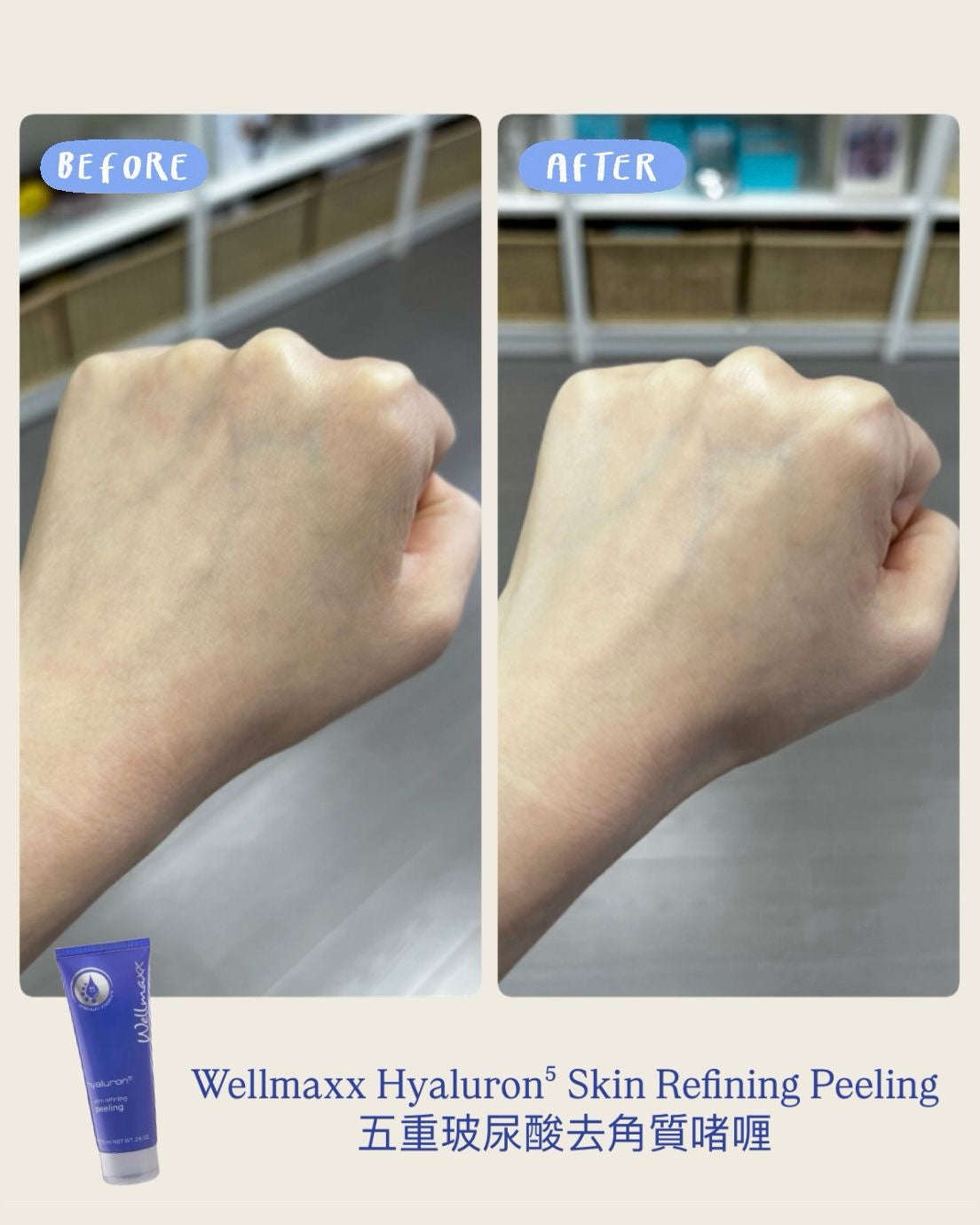 Wellmaxx 去角質啫喱使用前後對比：實測去除粗糙暗啞角質，使用後皮膚明顯變細緻、明亮及爽滑。